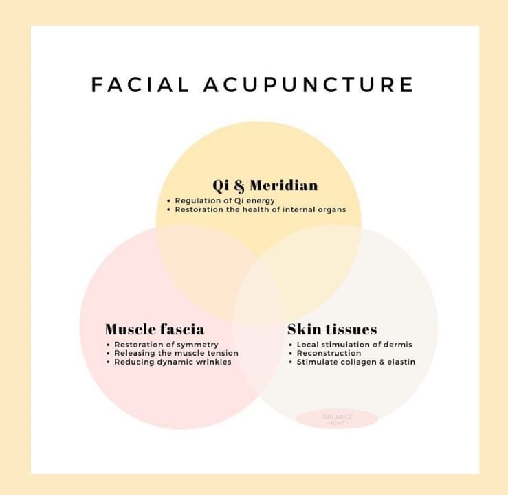 balancepointTCM's tweet photo. What acupuncture truly does! 💆🏼‍♀️ https://t.co/QxUNfjPNc6
