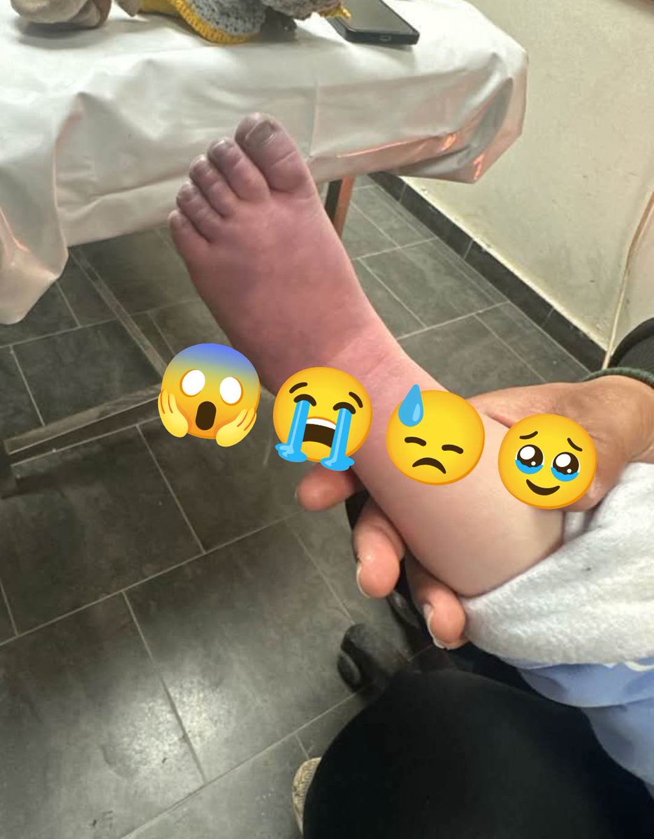 HE WILL DIE

It is very cold in the tents, MY  BROTHER'S feet have turned blue, he is shivering from the cold and hungry, I am very afraid that my brother will lose one of his feet from the cold, please help us by providing some BLANKET'S and warm clothes.
gofundme.com/f/help-muhamma…