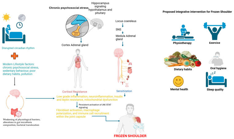 Omid_HopeUni's tweet photo. “Frozen Shoulder”

Overview of the multifactorial pathophysiology and proposed integrative treatment strategies👇🏼

#shoulder #health 
https://t.co/T7mgVVbGUO https://t.co/1ujMEPrLX3