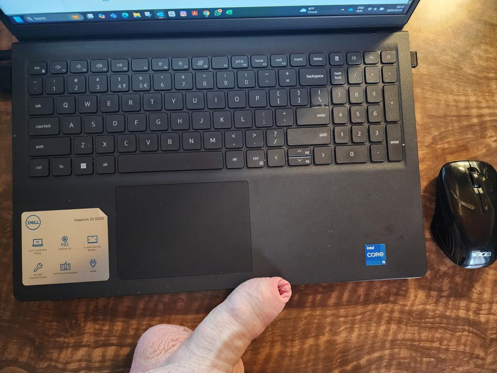 Vitiligo_Bear85 tweet media