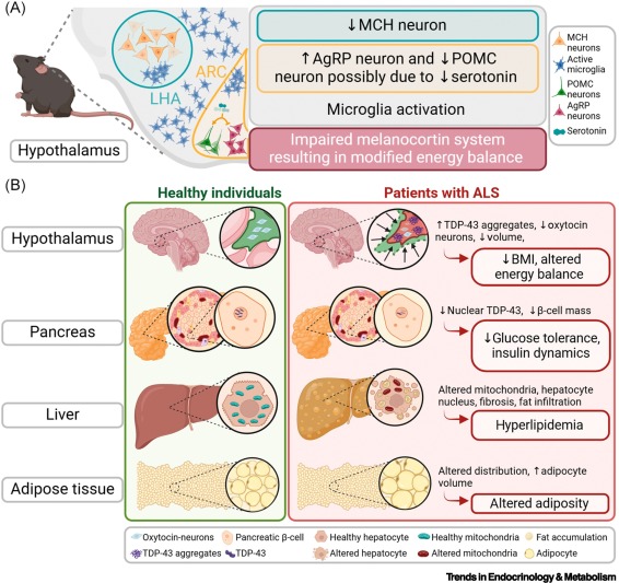 Online Now:  Hidden players in the metabolic vulnerabilities of amyotrophic lateral sclerosis dlvr.it/TJYWbZ #trends #endocrinology #metabolism
