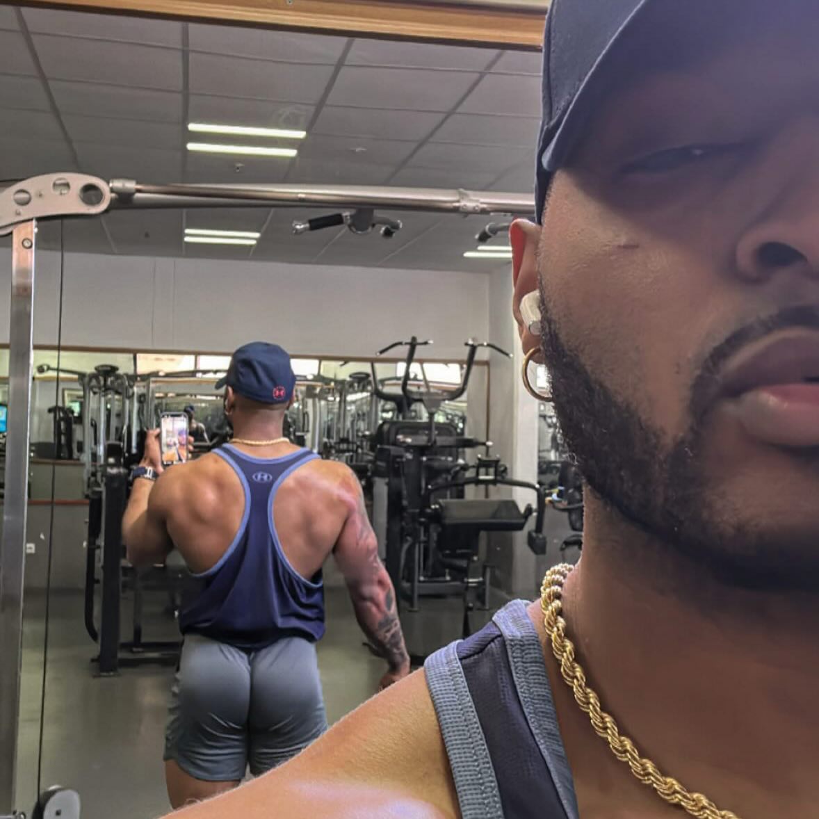 RaaayyL's tweet photo. Peep the cheek scar 🩹 Türkiye out here tryna fuck me up 😒#back #shoulders https://t.co/VeSHq2nwe3