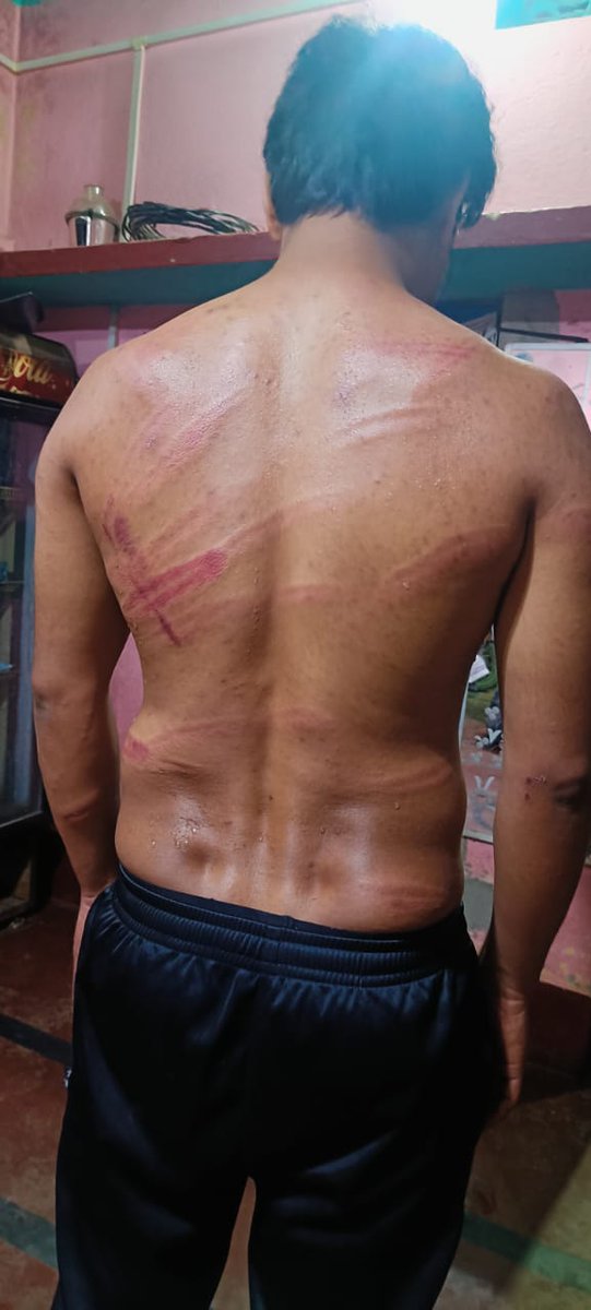 yourBabulal's tweet image. गिरिडीह के घोड़थंबा में इलेक्ट्रॉनिक्स की दुकान चलाने वाले विकास शाह को पुलिस ने जिस क्रुरता के साथ पीटा है, वह चीख चीख कर पुलिस की बर्बरता की गवाही दे रहा है।

@HemantSorenJMM जी, क्या इसी तरह जनता को पुलिसिया जुल्म के हवाले छोड़ दिया जाएगा? पुलिस की यह कारवाई बेहद शर्मनाक और…