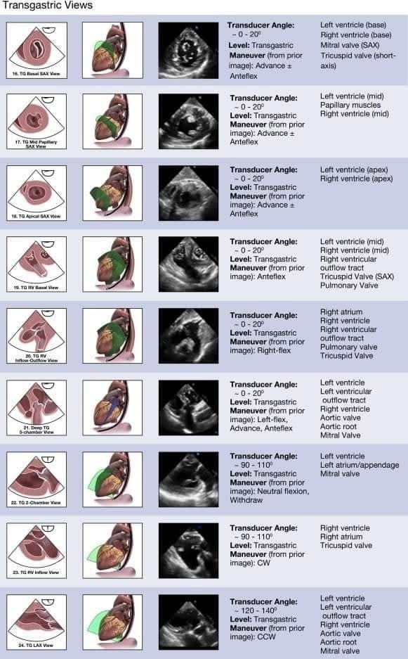 🔴 ASE Guidelines for Performing a Comprehensive Transesophageal Echocardiographic Examination
🔹  Midesophageal Views
🔹  Transgastric Views
🔹  Mitral Valve Views

sciencedirect.com/science/articl…
#Transesophageal #TEE #Echocardiogram #Cardiology #Windows #Echocardiography
