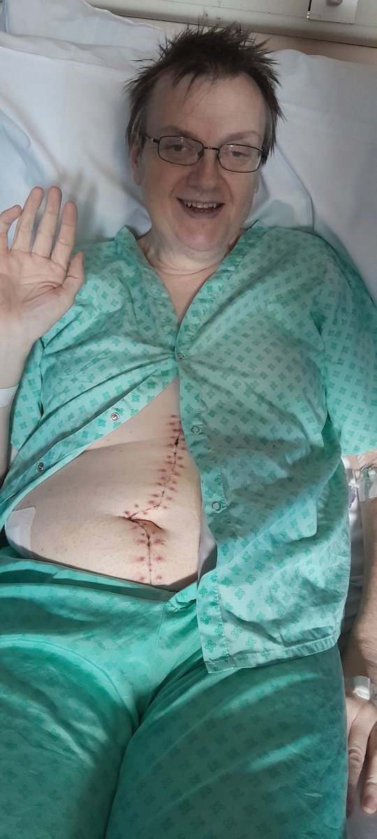 ijtscripts's tweet photo. @tiscooperwoman Best wishes to your sister. 💙 I had similar at Christmas. It's a tough fight but the pain will lessen and she will learn to live with the stoma. https://t.co/E7UqapnfmQ