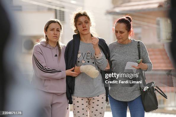 GettyImagesNews's tweet photo. At least 59 people have died after a #fire broke out overnight at the #Pulse Club in #Kocani, #NorthMacedonia, with more than 100 people injured. Reportedly, the club's roof caught fire from pyrotechnics set off during a concert at the venue. 📷: Ferdi Limani https://t.co/iKcm9k9lNi