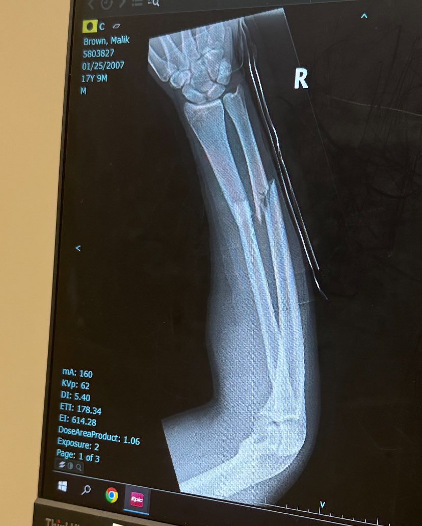 Malikbrown07's tweet photo. Broke my arm 4 months ago in a game(rushed for 150 just in the first 2 quarters in that game),that injury didn’t stop my hunger to be GREAT💯 #GODFIRST 
@un_FOURgettable  @Coach_Filkovski  @On3Recruits https://t.co/by6uRw7YHK