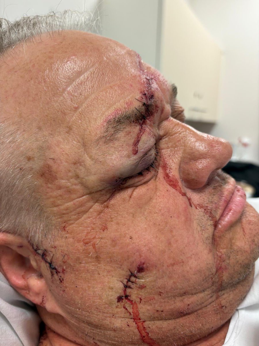 Spare a thought for my dear friend Rob a massive Newcastle Fan who tackled a man with a knife breaking into his house last night. He was already and very excited to be going to Wembley today but sadly he’s in Hospital recovering let’s hope Newcastle win.