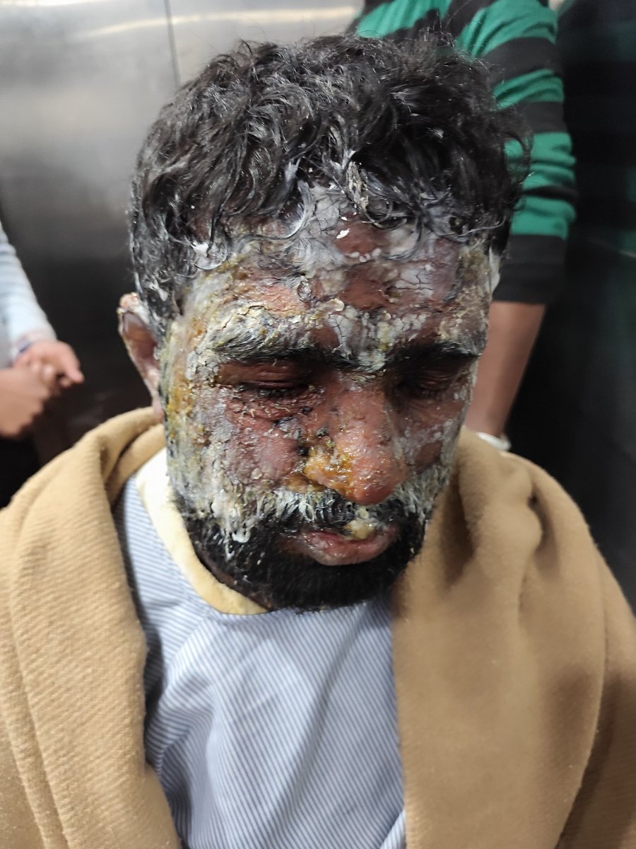 पत्नी चाहे जितने मर्जी अत्याचार पति पर कर सकती है, मगर पति कुछ नहीं कर सकता

ये है देश का कानून 

आओ मिलकर #LegalTerrorism
के खिलाफ आवाज उठाए 

19 April 2025 जंतर मंतर दिल्ली 

#SatyagrahaForMen 
#SpeakUpMen
#MensSucide