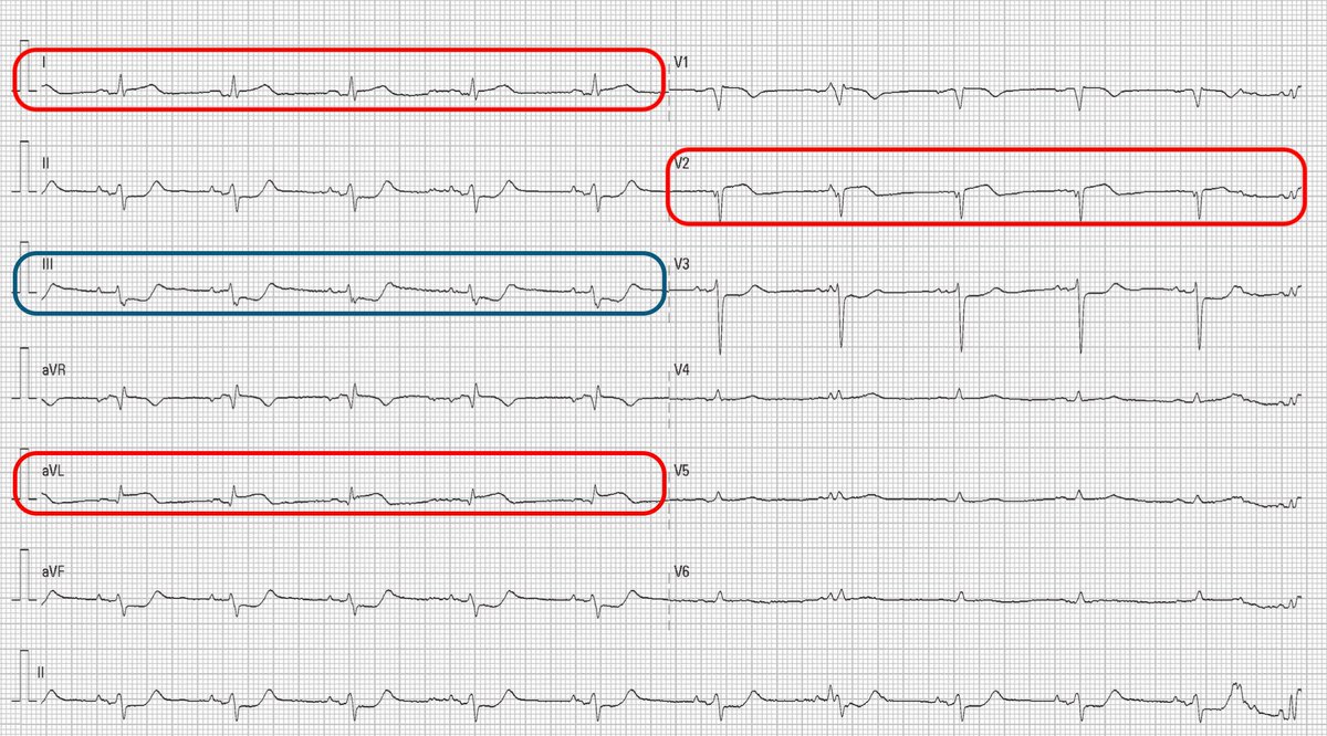 Tommy Chavero tweet media