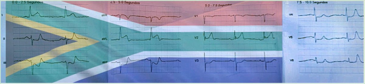 Tommy Chavero tweet media