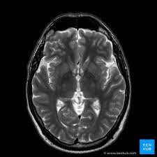 lesmakers_fr's tweet photo. Le plus grand mensonge sur l'expertise :

"Le talent est inné, on naît doué ou on ne l'est pas."

Ce scientifique a passé 30 ans à prouver le contraire.

Ses travaux montrent que l'excellence est accessible à tous.

Voici comment devenir expert dans n'importe quel domaine : https://t.co/HZd2P3FJQV