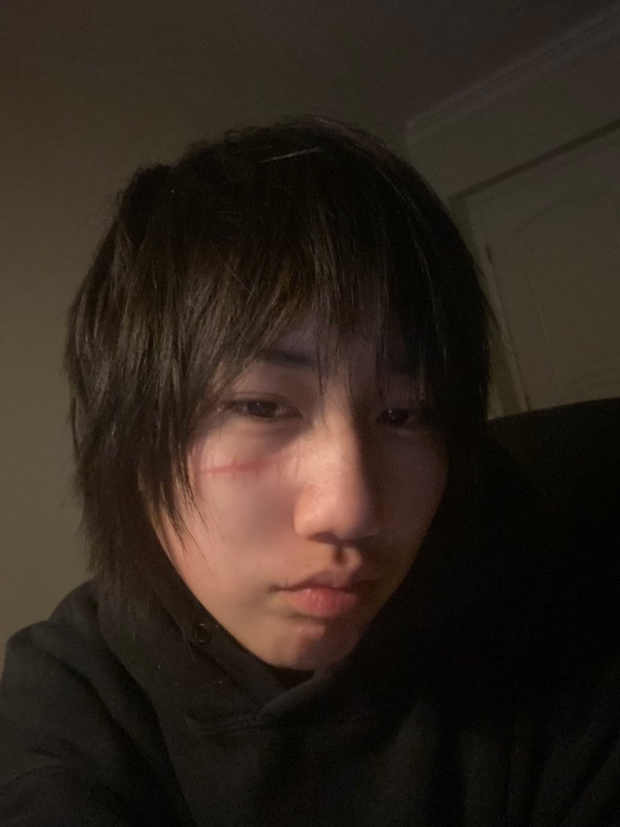 fackingnefor's tweet image. guy who is going to KILL HIMSELF (buccal fat is back after gaining 🥀)