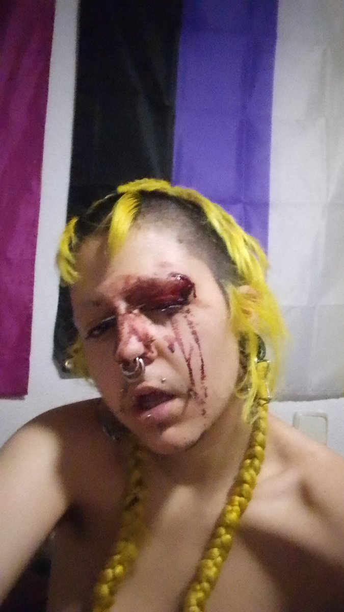 mapachepunki's tweet photo. acabo d recibir una paliza x ser visiblemente trans https://t.co/KpI8tuo0Dj