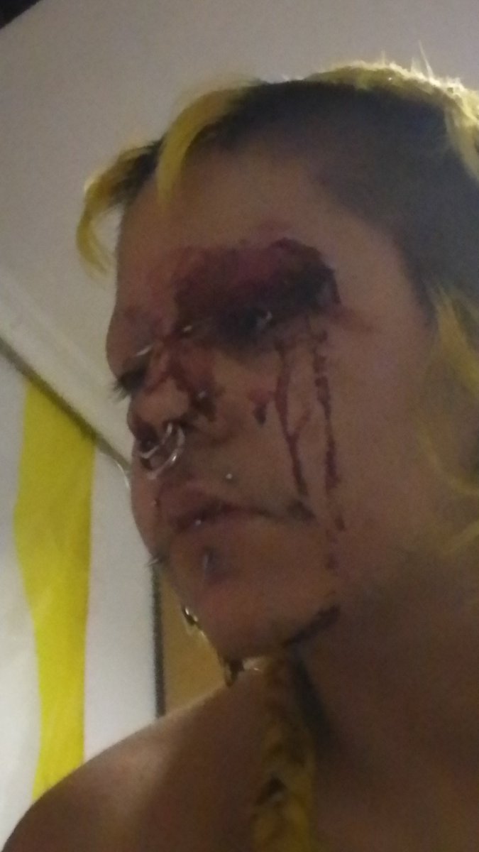 mapachepunki's tweet photo. acabo d recibir una paliza x ser visiblemente trans https://t.co/KpI8tuo0Dj