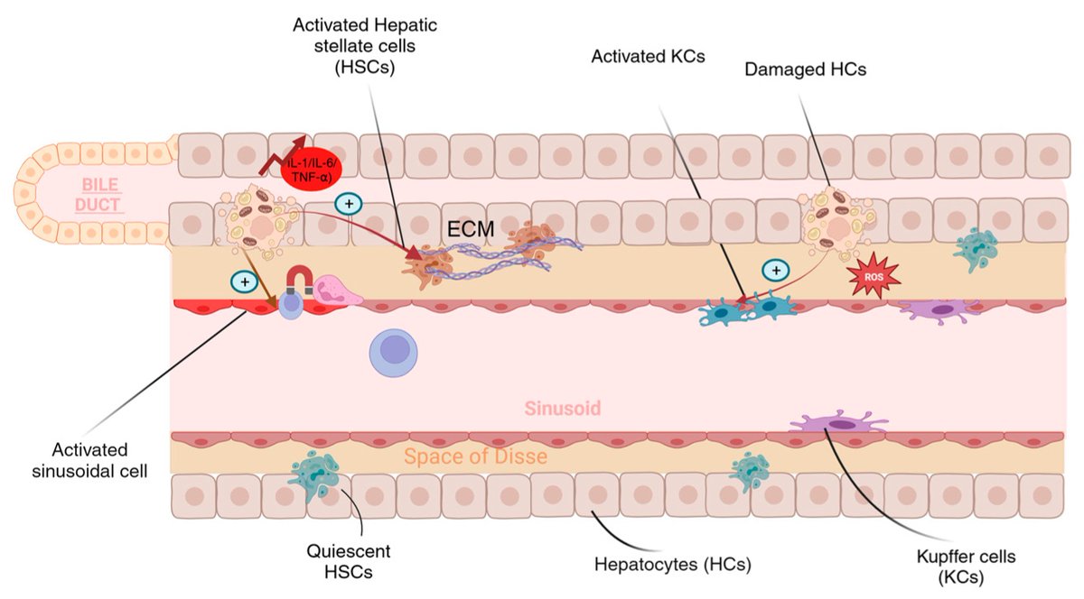 Non_Coding_RNA's tweet photo. 🌟Presenting Our Review Paper🌟

"Investigating the Role of Non-Coding #RNA in Non-Alcoholic Fatty Liver #Disease" from Samar A. Zailaie  et al.
#ncRNA #miRNA #PiwiRNA #LncRNA #CircRNA @MDPIOpenAccess 

Full text: https://t.co/jJada40jqd https://t.co/aZUgEZ3uIH