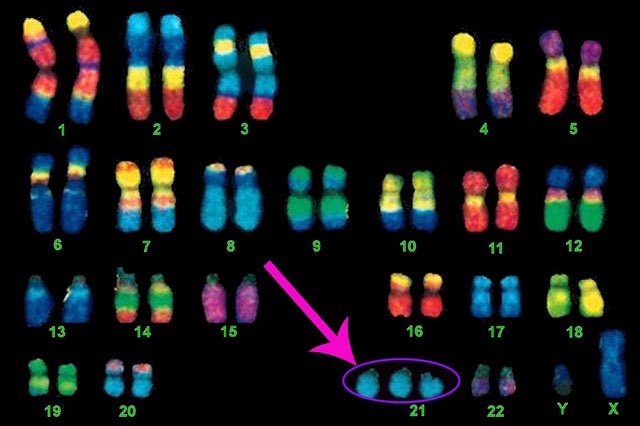 pdsacemail's tweet photo. Join us on March 21 in celebrating #WorldDownSyndromeDay. Wear your most colorful and even mismatched socks! Did you know that chromosomes look like colorful socks? Tag us in your photos! #WDSD https://t.co/Cns0eqIaGw