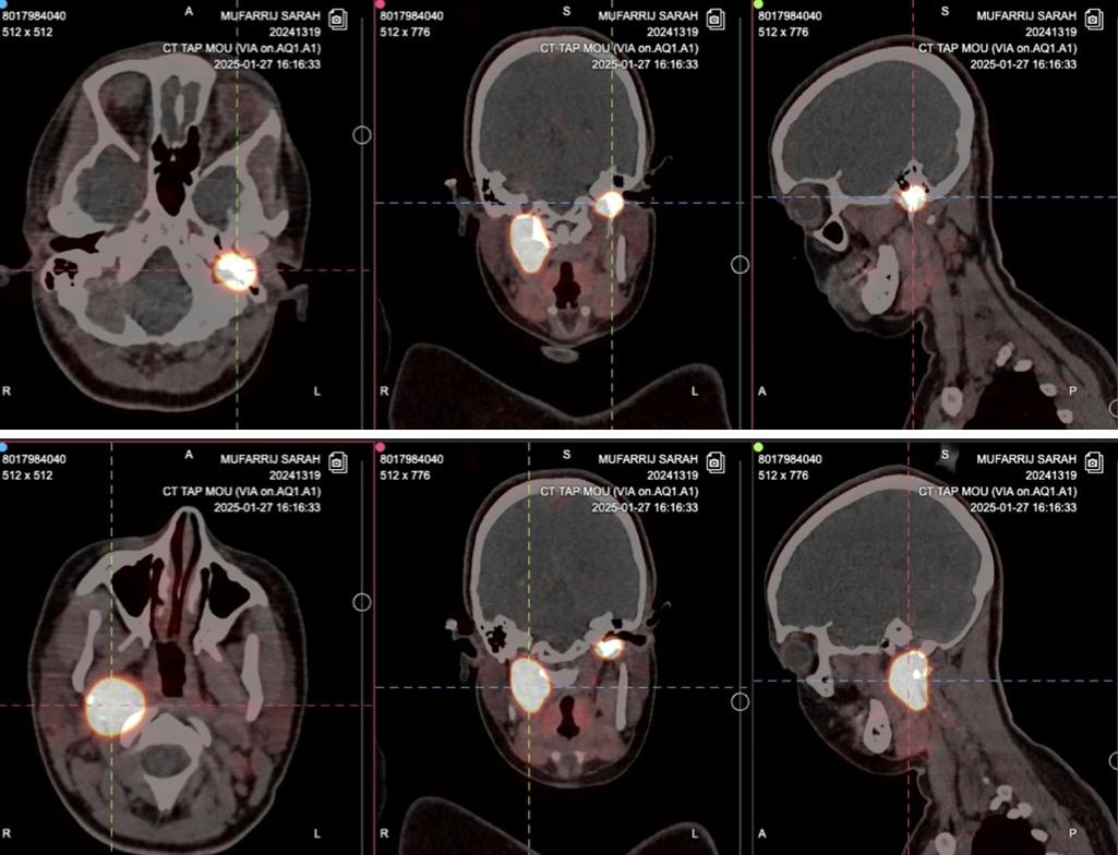 As some of you might know, I have two tumors in my head, currently classified as inoperable. They could have been found earlier, but they weren’t.

Because my symptoms were dismissed.
Because my condition is rare.
Because my medical history was too fragmented for doctors to