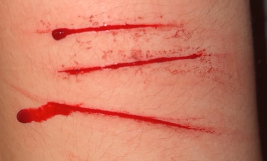 vamp_mela's tweet photo. @skekenssk tw fresh styros and healed (sometimes x doesnt censor my pics) https://t.co/eIr7EuuXwm
