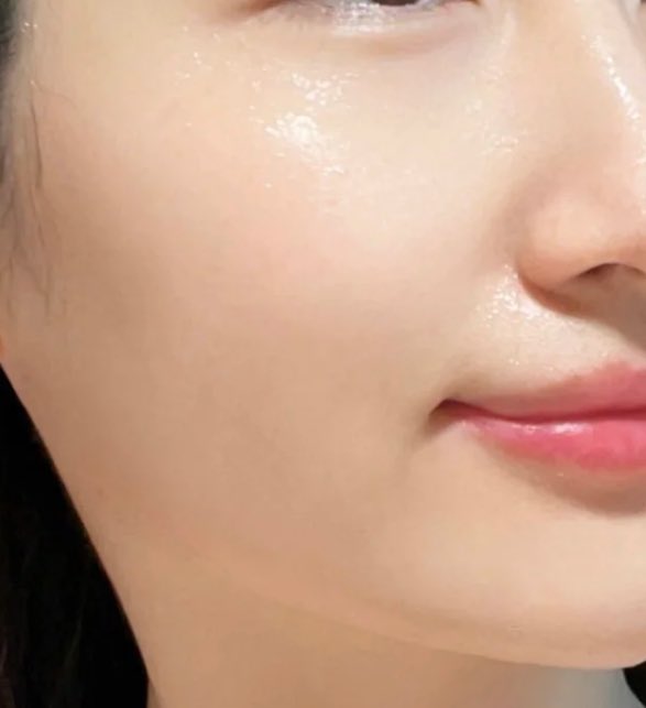 リジュランとジュベルックを分けてやる！
💉2ヶ月に1回リジュラン4cc
💉2ヶ月に1回ジュベルック2cc+スキンボト2cc
これ交互にすると毛穴も無くなるし艶肌になる
リジュランとジュベルック同時にやるより分ける方がオススメ
そしたらすっぴんでこういう肌になる