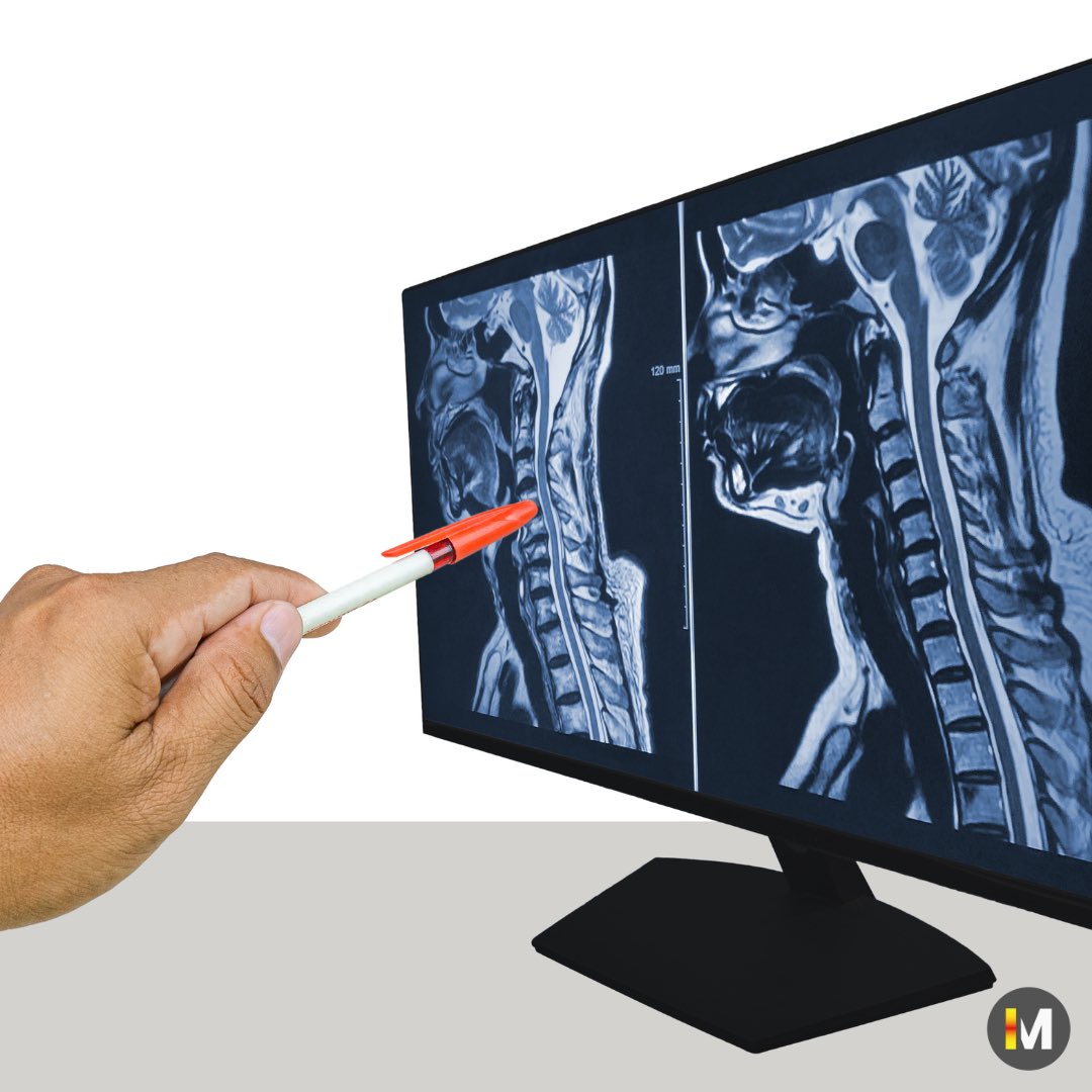 Myelopathy org tweet media
