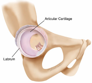nashvilleorthos's tweet image. #Labrum &amp;amp; #articularcartilage are critical in maintaining hip function
🔹Labrum acts as a gasket, distributing weight across the hip socket
 🔹Articular cartilage provides a smooth, frictionless surface
Damage to either can cause pain/lead to #arthritis👉medilink.us/yyes