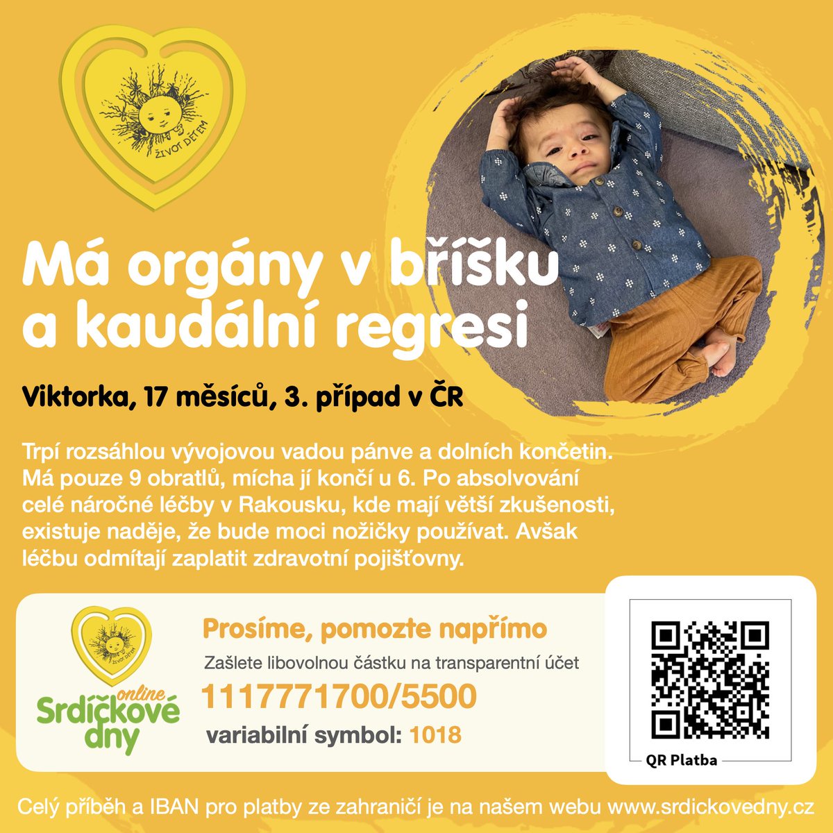 ZivotDetem's tweet photo. Celou reportáž jsme vám uveřejnili včera na našem FB, najdete ji zde https://t.co/6Vt3xHT5Wh . Více informací na našem webu https://t.co/0wpaxTLHMx . Maminka Viktorky vám bude moc vděčná. Děkujeme! ❤️ https://t.co/HeivNk6izc