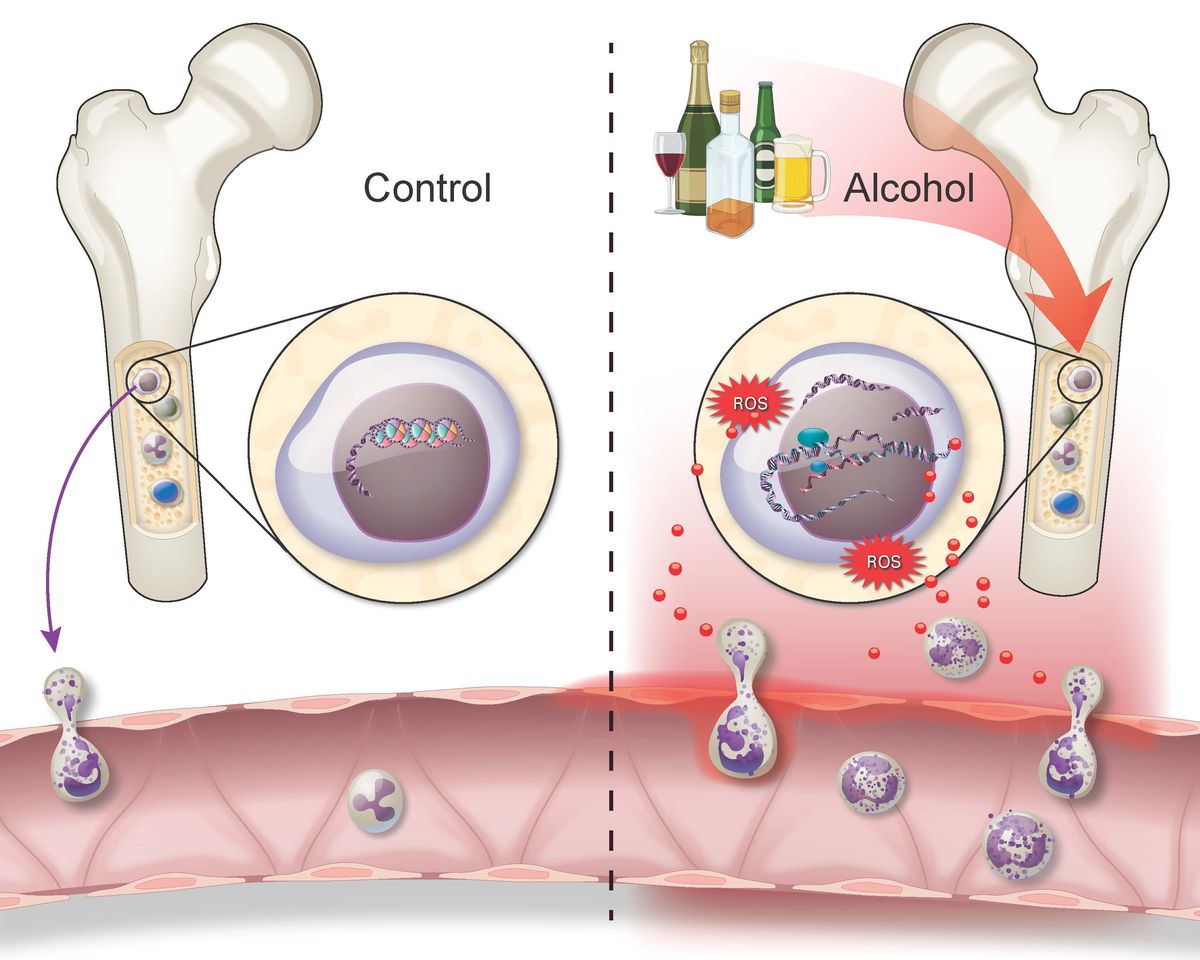⚠️ If you want to protect your immune system, stop drinking.

Even a single binge can trigger inflammation within 20 minutes.

Moderate drinking alters immune responses, while chronic use weakens defenses and fuels long-term inflammation 🧵 1/9