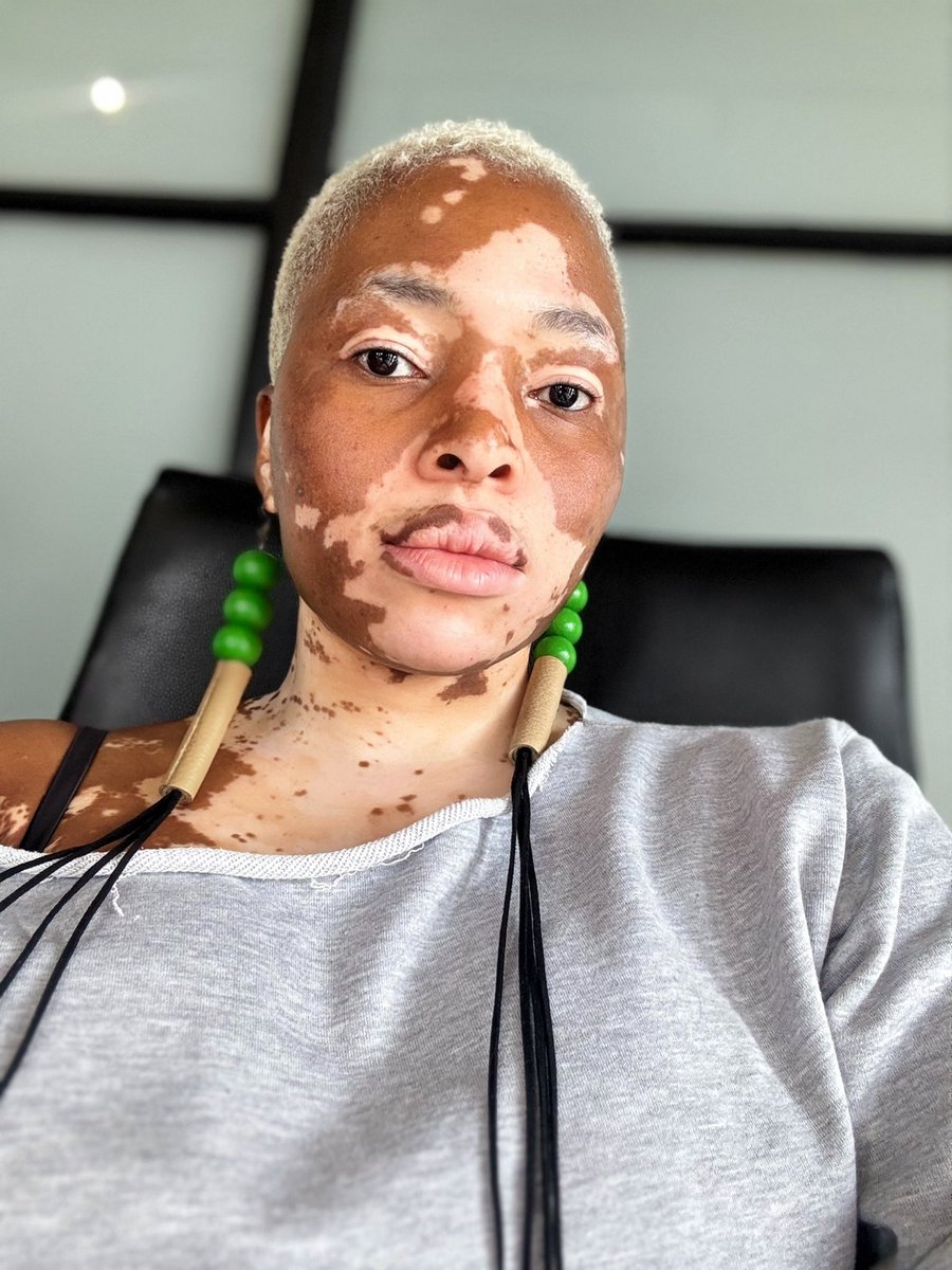 yolandamukondi's tweet photo. No make up challenge 🤭 let’s goooo 🙈🙈 https://t.co/ilzpgTPqD8