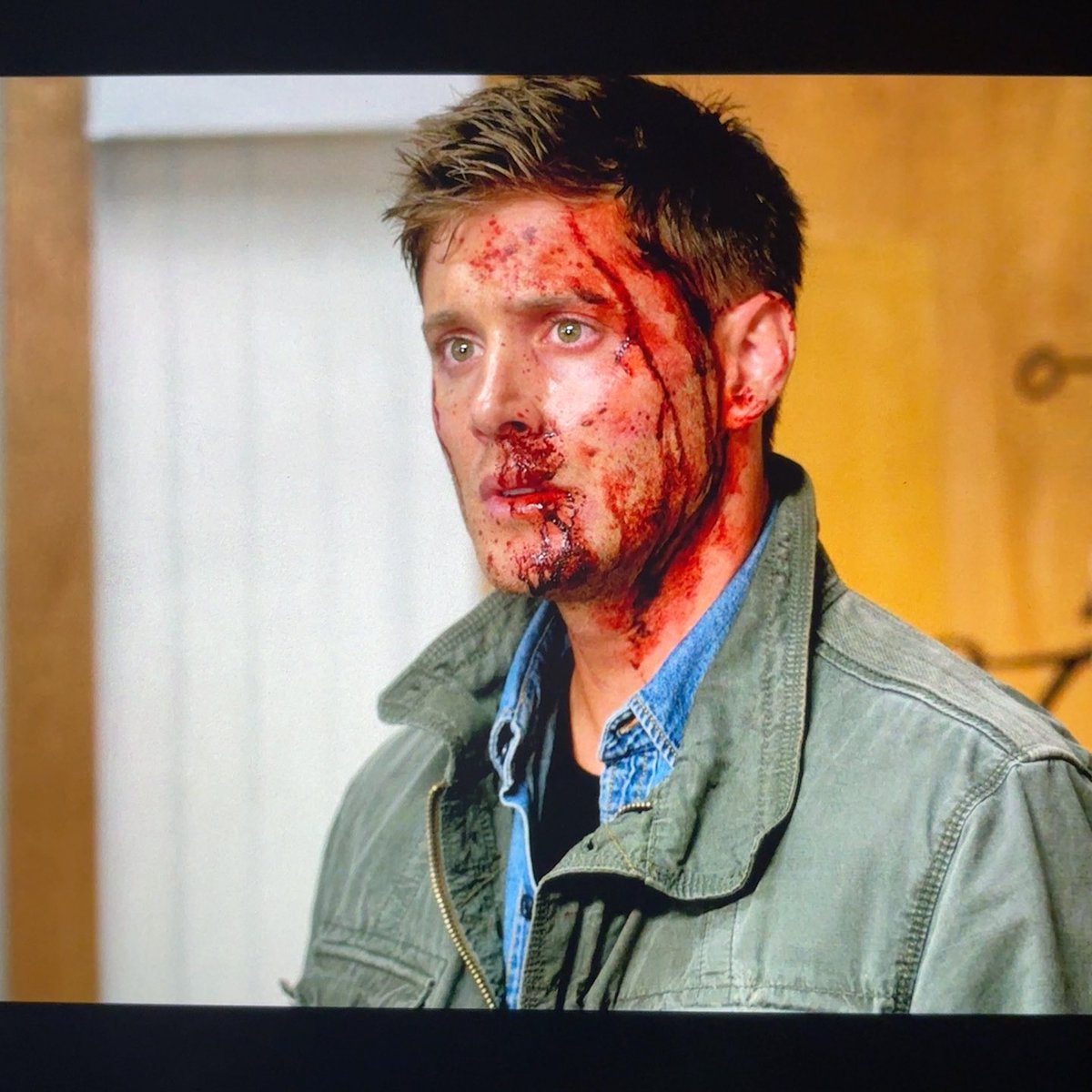 Dear God, I know it’s bad... but Dean Winchester covered in blood