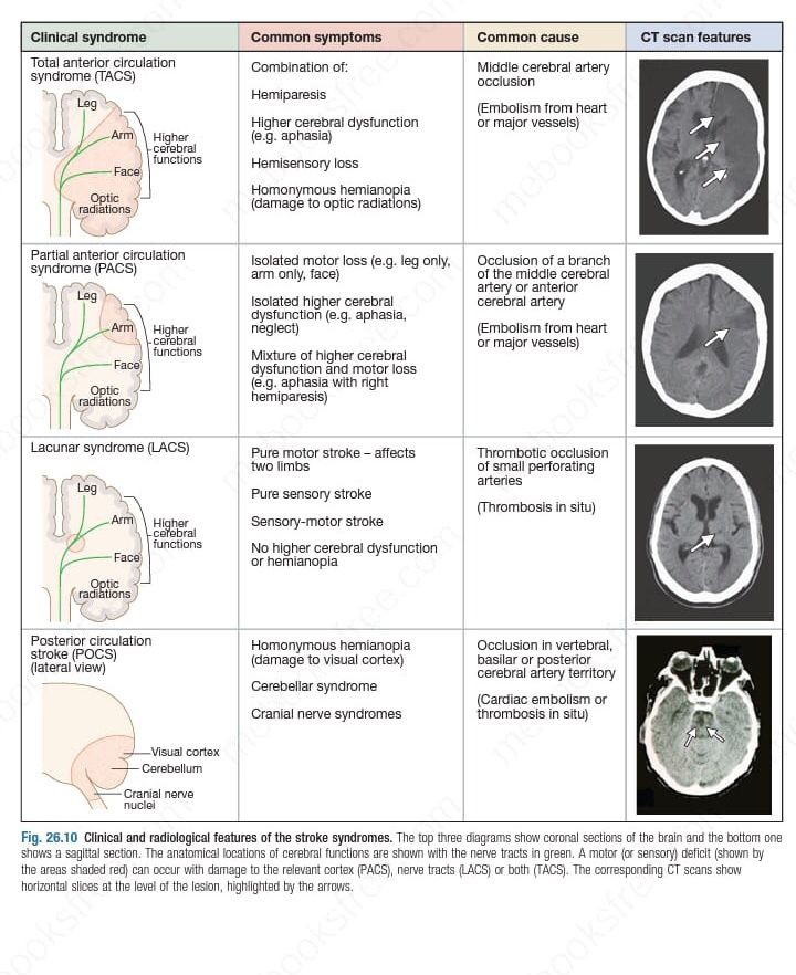drsthanus's tweet image. Clinical and Radiological Features of the Stroke Syndromes.
@ManualOMedicine