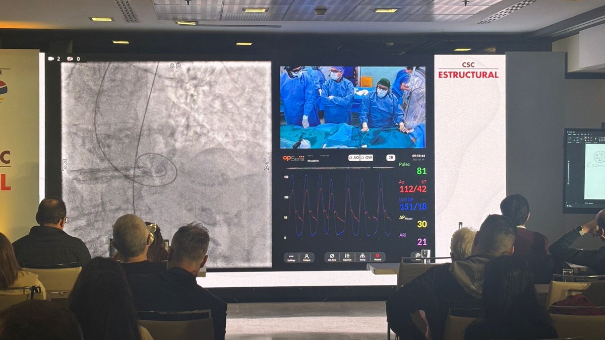 CARDIVA (@cardivagroup) on Twitter photo 🫀 La división de #CardiologíaIntervencionista ha estado presente en el #CSCestructural, la reunión de referencia en la especialidad desde un punto de vista práctico.
En concreto, ha apoyado un caso en vivo de #TAVI realizado desde el <a href="/hospitalclinic/">Hospital Clínic</a> por el Dr. <a href="/AnderRegueiro/">Ander Regueiro</a>. 🫀 La división de #CardiologíaIntervencionista ha estado presente en el #CSCestructural, la reunión de referencia en la especialidad desde un punto de vista práctico.
En concreto, ha apoyado un caso en vivo de #TAVI realizado desde el <a href="/hospitalclinic/">Hospital Clínic</a> por el Dr. <a href="/AnderRegueiro/">Ander Regueiro</a>.