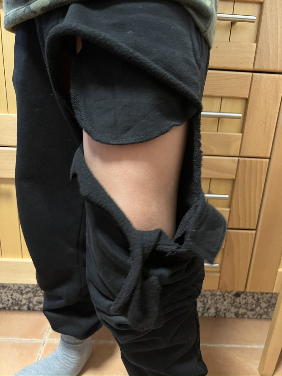 Convivir con una discapacidad grave, también es esto.
Mi hijo pequeño ahora pasa por una fase de romperse toda la ropa.
Ya no solo es la obsesión por grifos, agua, líquidos y mojarlo todo.
Se destroza los pantalones, las camisetas, con lo que pille.
⬇️