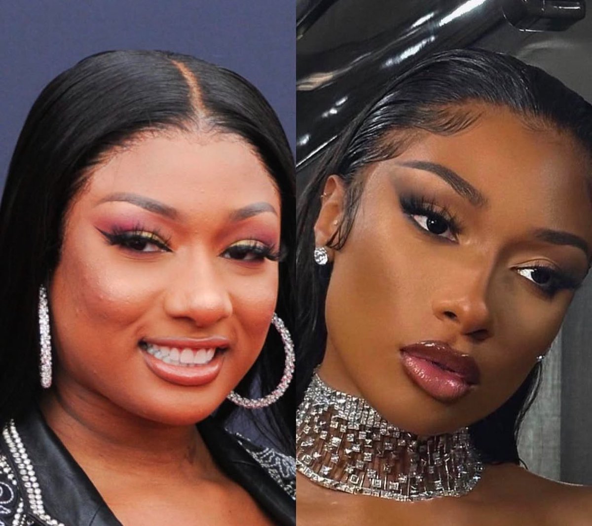 TheCosmeticLane's tweet image. Let’s talk… Is it a rhinoplasty or just good makeup?