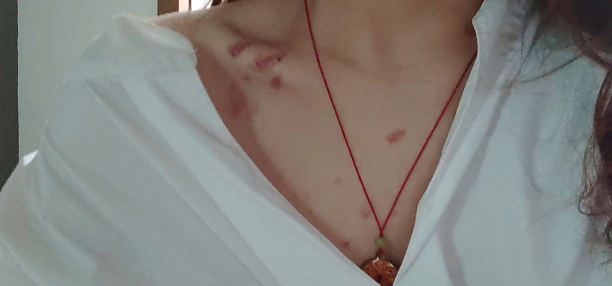 吻痣 #les #wlw #拉拉