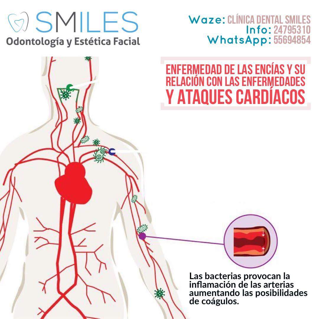 SmilesGT's tweet photo. Una limpieza dental puede cuidar más alla de tus encías y dientes. Agenda al 55694854 https://t.co/u0duR1zo9L