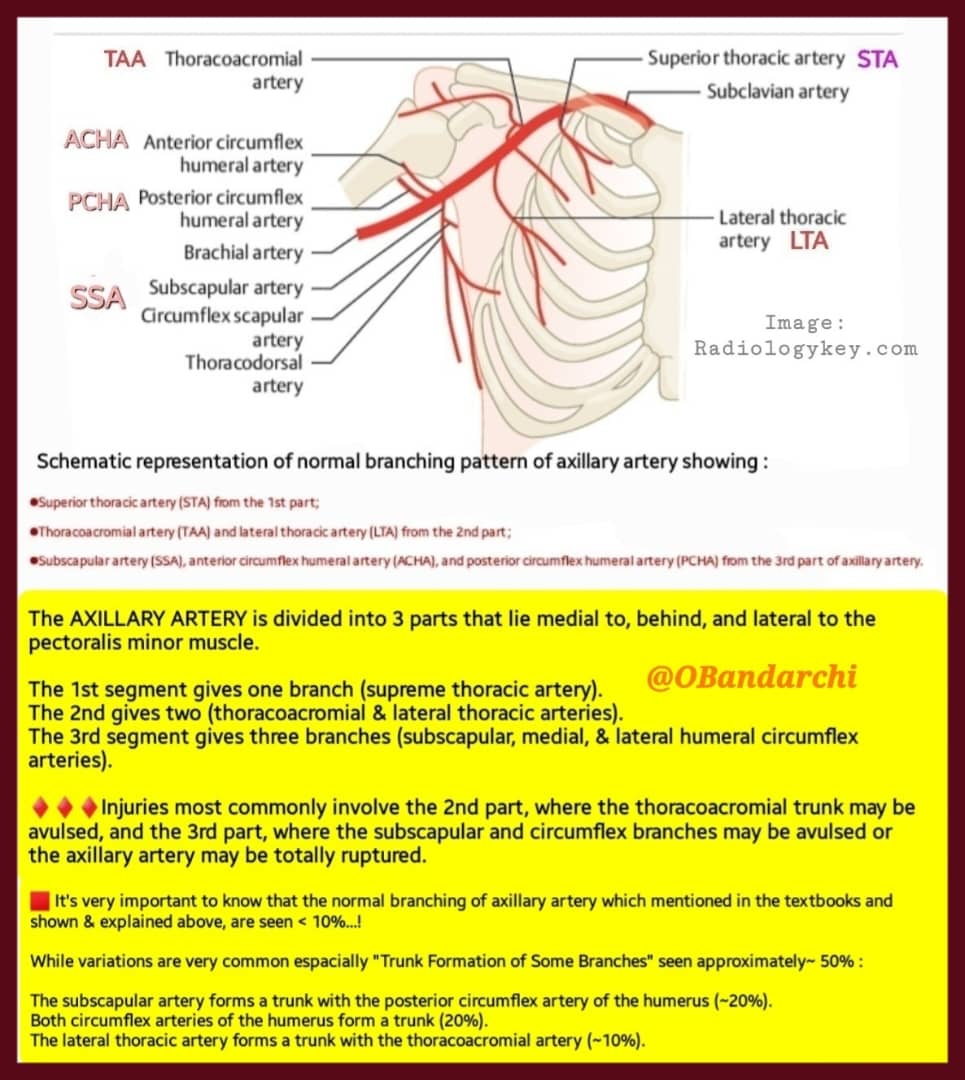 OBandarchi's tweet photo. 🛑Normal branching pattern of axillary artery shown.

It's worth knowing that normal branching of axillary artery which mentioned in the textbooks &amp; shown here are seen in only< 10%.

On the other hand, variations are common esp. "Trunk Formation of Some Branches" which seen~ 50% https://t.co/L8hShCEBg5