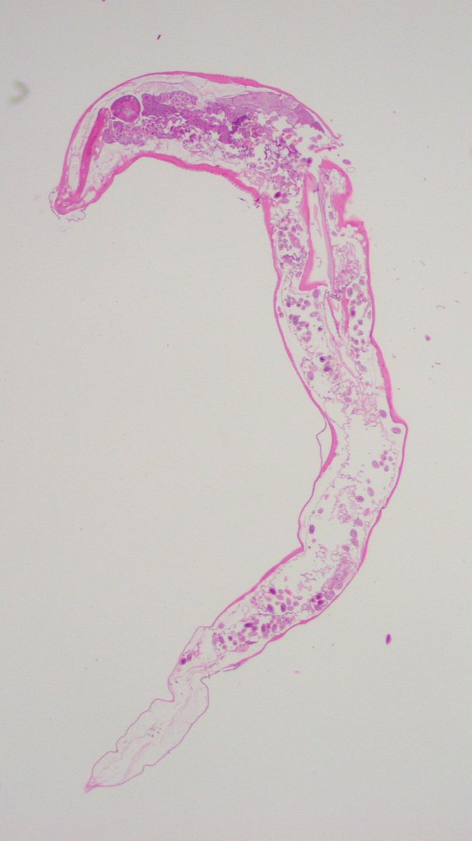 But isn't she so pretty? 🥰😅

This was probably one of the most unique slides I've seen during residency so far #PathX🔬  #PathTwitter #path2path