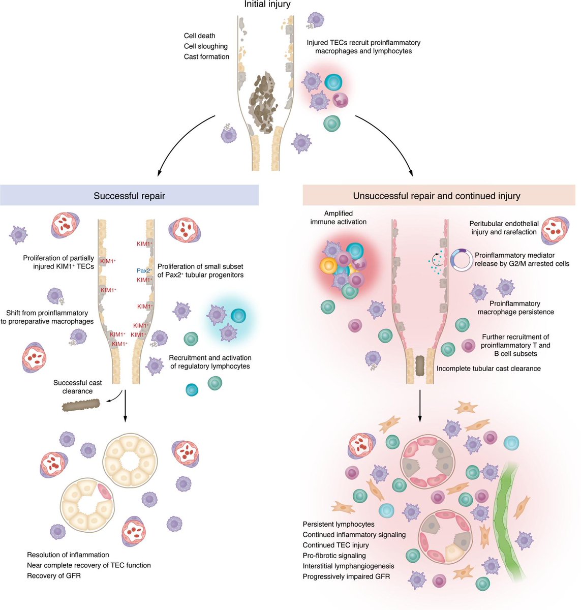 Yale Nephrology (@yalenephrology) on Twitter photo Just published review in today’s issue of <a href="/jclinicalinvest/">Journal of Clinical Investigation</a> by <a href="/meganlebaker/">Megan Baker</a> and <a href="/lloydcantley1/">Lloyd Cantley</a> — Adding insult to injury: the spectrum of tubulointerstitial responses in acute kidney injury!!
Check it out! 🔗👉jci.org/articles/view/…
<a href="/YaleIMed/">Yale Internal Medicine</a> <a href="/YaleMed/">Yale School of Medicine</a> Just published review in today’s issue of <a href="/jclinicalinvest/">Journal of Clinical Investigation</a> by <a href="/meganlebaker/">Megan Baker</a> and <a href="/lloydcantley1/">Lloyd Cantley</a> — Adding insult to injury: the spectrum of tubulointerstitial responses in acute kidney injury!!
Check it out! 🔗👉jci.org/articles/view/…
<a href="/YaleIMed/">Yale Internal Medicine</a> <a href="/YaleMed/">Yale School of Medicine</a>