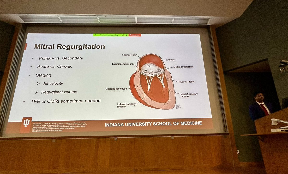 Jennifer Hur, MD (@hurjennifer) on Twitter photo Monday Senior Seminar learning! Cystatin C for more accurate assessment of eGFR by Will Voors, and review of Mitral Valve Disorders by Avi Rajasekaran. 🫘and 🫀<a href="/IUIntMed/">Indiana University Internal Medicine</a> <a href="/IUSMDeptMed/">IU School of Medicine Department of Medicine</a> Monday Senior Seminar learning! Cystatin C for more accurate assessment of eGFR by Will Voors, and review of Mitral Valve Disorders by Avi Rajasekaran. 🫘and 🫀<a href="/IUIntMed/">Indiana University Internal Medicine</a> <a href="/IUSMDeptMed/">IU School of Medicine Department of Medicine</a>