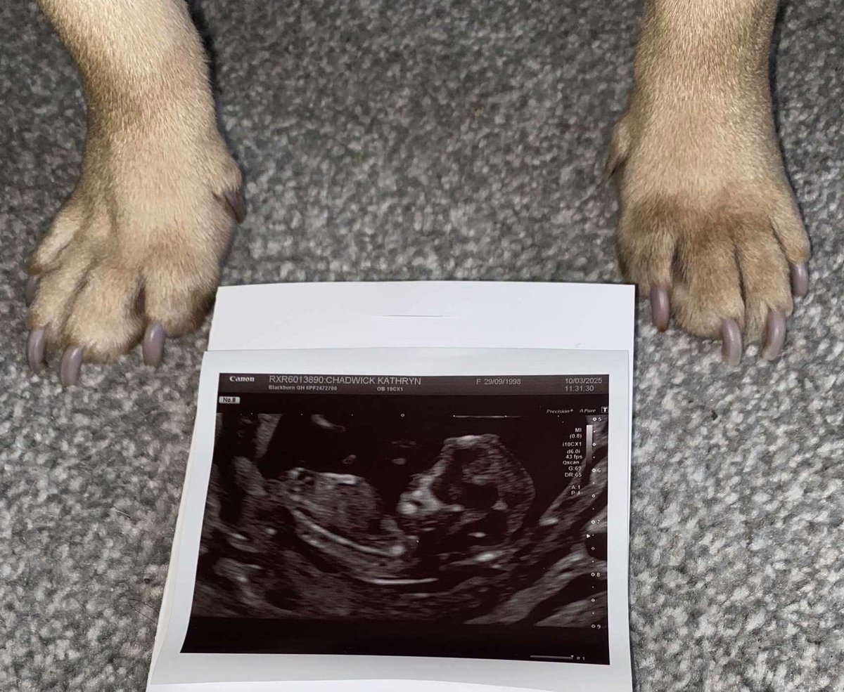 Excited to announce the permanent signing of BABY CHADWICK on a lifetime deal and will be joining the family in September 2025 ✍️ 👶 💙🤍