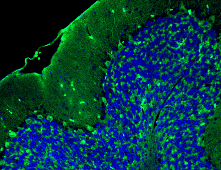 Science Magazine (@sciencemagazine) on Twitter photo Using a newly developed STING-reporter mouse, scientists demonstrate how immune cells tune STING signaling to enable normal development and prevent unnecessary inflammation during homeostasis.
Learn more in <a href="/SciImmunology/">Science Immunology</a>: scim.ag/3Dp0eNR Using a newly developed STING-reporter mouse, scientists demonstrate how immune cells tune STING signaling to enable normal development and prevent unnecessary inflammation during homeostasis.
Learn more in <a href="/SciImmunology/">Science Immunology</a>: scim.ag/3Dp0eNR