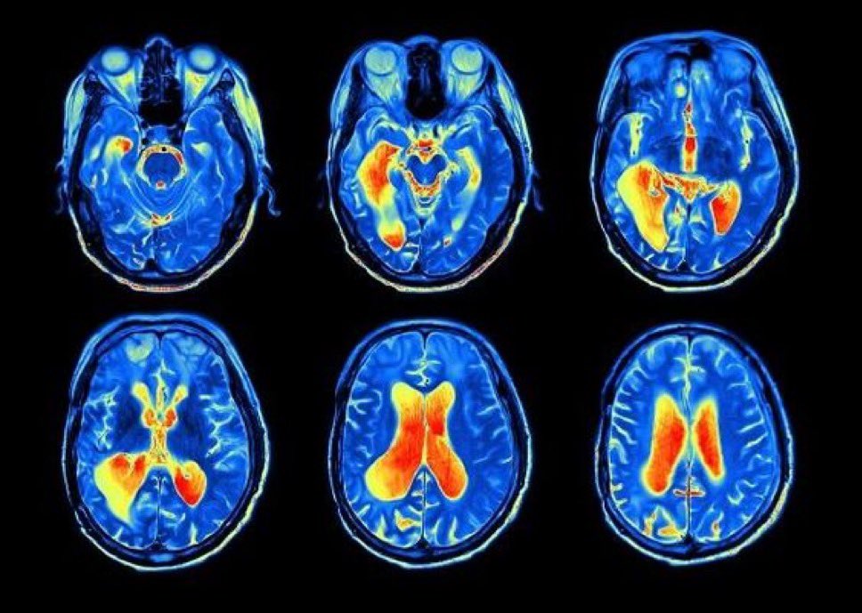 I've manifested over 300 things last year

Want to know why you struggle to manifest? 

You aren’t using your Attention correctly

Open this🧵