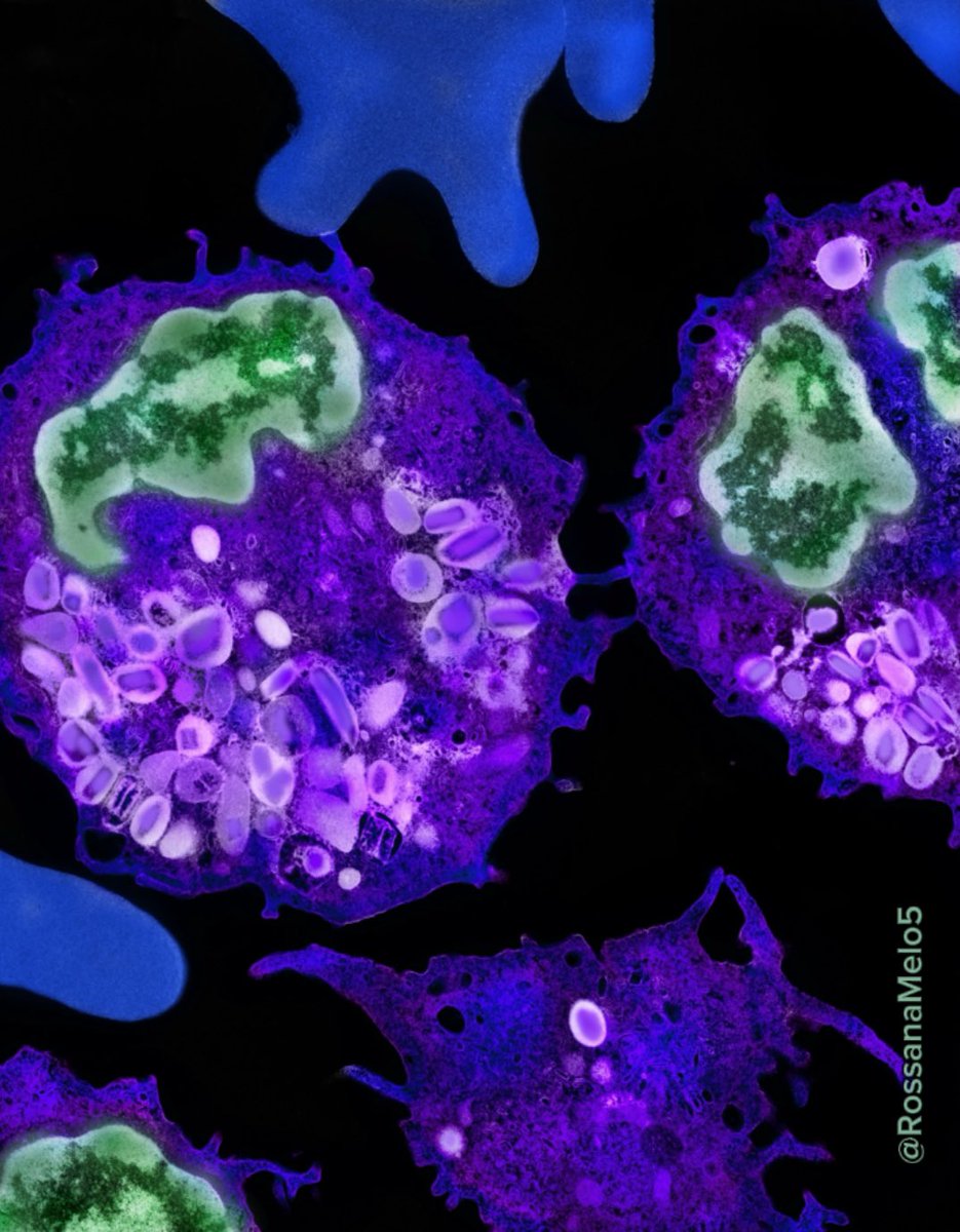 An incredible view of the human #blood showing #eosinophils and RBCs under electron #microscopy 🤩
#microscopymonday