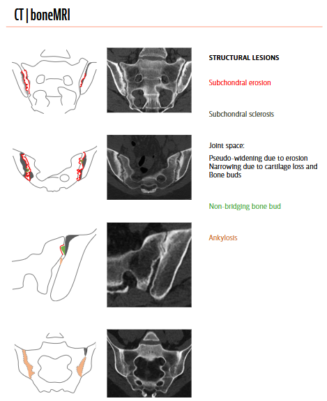 Rheumatology's tweet photo. ARTHRITIS IMAGING

Free Preview

https://t.co/wZy61dfdcN https://t.co/jX7RdYheKd