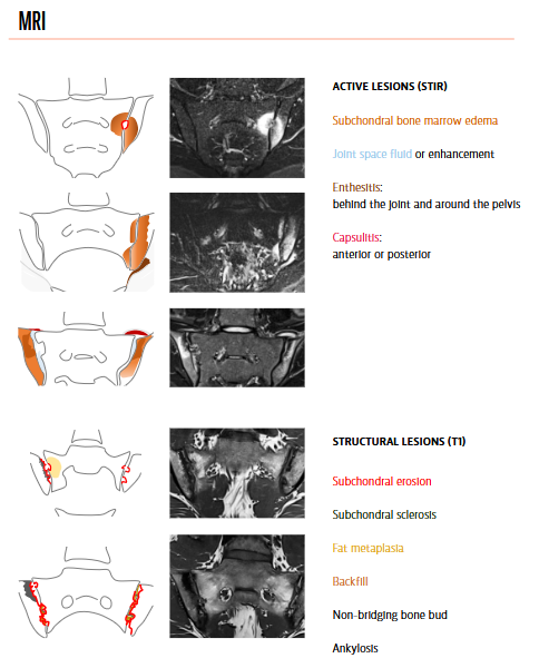 Rheumatology's tweet photo. ARTHRITIS IMAGING

Free Preview

https://t.co/wZy61dfdcN https://t.co/jX7RdYheKd