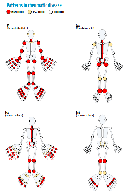 ARTHRITIS IMAGING

Free Preview

cdn.shopify.com/s/files/1/0550…