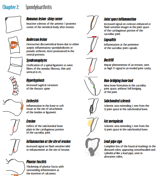 Rheumatology's tweet photo. ARTHRITIS IMAGING

Free Preview

https://t.co/wZy61dfdcN https://t.co/jX7RdYheKd