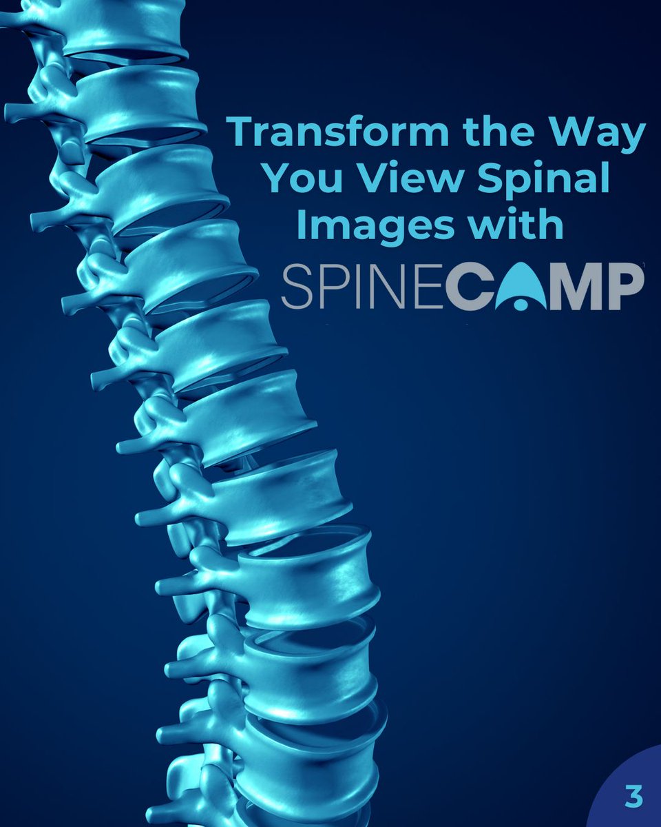 SpineCAMP's tweet photo. From alignment to motion, SpineCAMP supports clinical decision-making with precision.
The metrics produced by SpineCAMP are intended to be used to support qualified and licensed professional healthcare practitioners in clinical decision-making for skeletally mature patients 18+. https://t.co/P2eLpiIIny