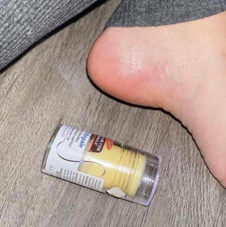 theiceraf's tweet image. Selain muka licin, tumit kaki pon kena licin jugak. Korang sapu jer before tidur setiap malam, baru la cepat dapat result best2!!

Yang penting, no more tumit kaki merekah and kering lepasni 🥹🫶🏻